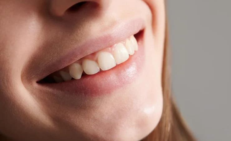 Diş Beyazlatma Kalıcı Bir Çözüm Mü? İşte Beyaz Gülüşlerin Ömrünü Belirleyen Faktörler
