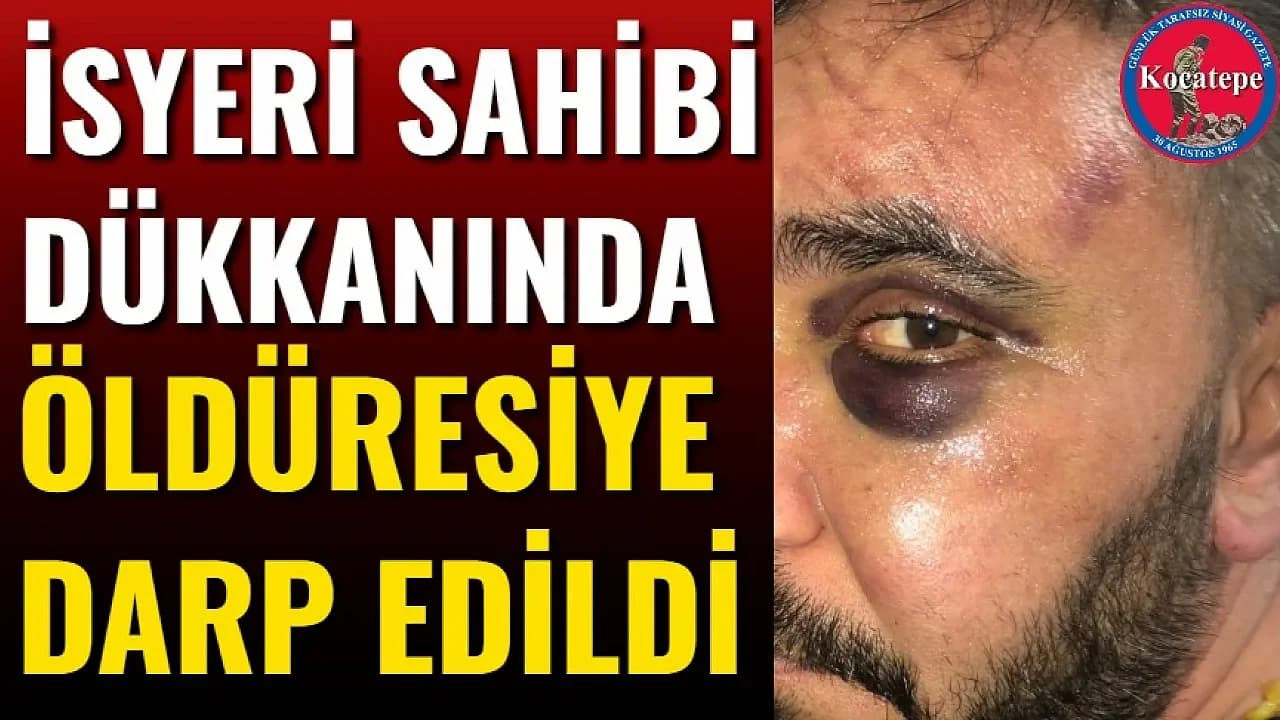 Afyonkarahisar’da ‘Karavan’ Öfkesi: Restoran Sahibine Dükkanında Dehşet Dolu Saldırı